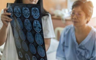 Lesiones cerebrales traumáticas y su derecho a una compensación económica en Florida
